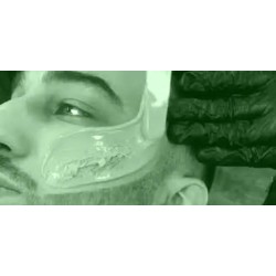 Depilación Facial / Facial Hair Removal