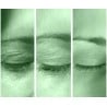 Tratamiento Tensor con Fibroblast / (Plasma Lift)