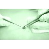 Exceresis de Verrugas / Plasma Skin Lesion Removal