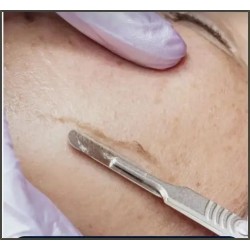 Dermaplaning Facial / Facial Dermaplaning