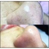 Limpieza Profunda / Deep Pore Cleansing Facial
