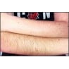 Depilación de Brazo / Arm Hair Removal