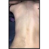 Depilación de Espalada / Back Hair Removal