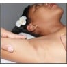 Depilación de Axilas / Underarm Hair Removal